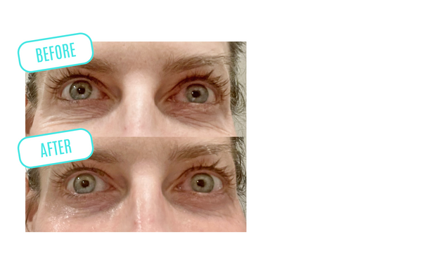 Before and after close up image of a woman's eyes